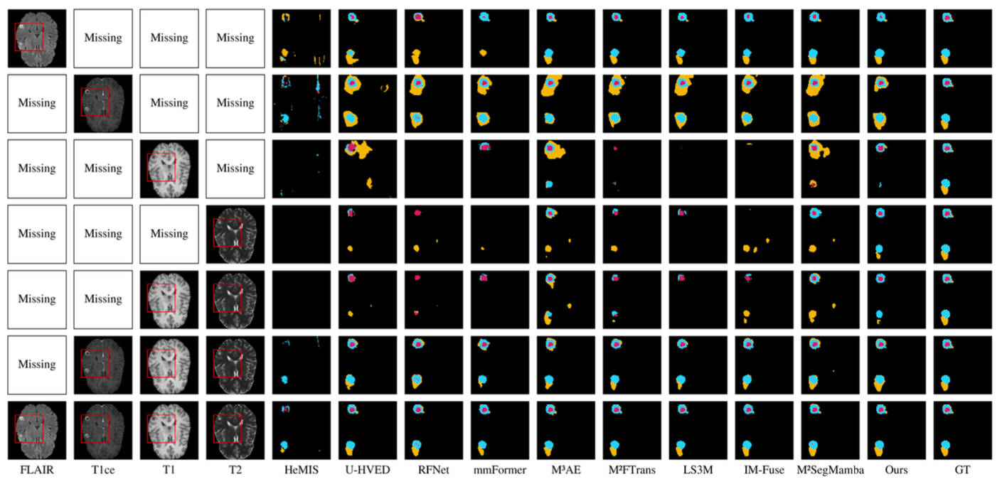 Visualization of segmentation results on BraTS 2023
